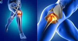 Explore Joint Replacement Surgery: Overview, Explanation, Facts, and Helpful Recovery Resources