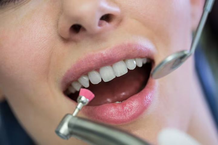 Exploring Dental Cleaning and Oral Health