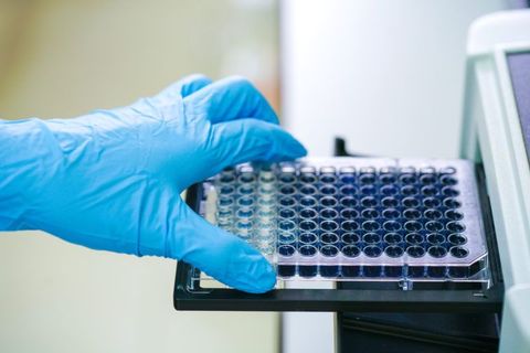 Discover Assay Development A Clear and Practical Guide for Researchers, Healthcare Professionals, and Industry Learners