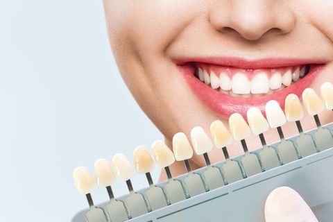 Tips for Understanding Teeth Whitening Options and Maintaining a Brighter Smile