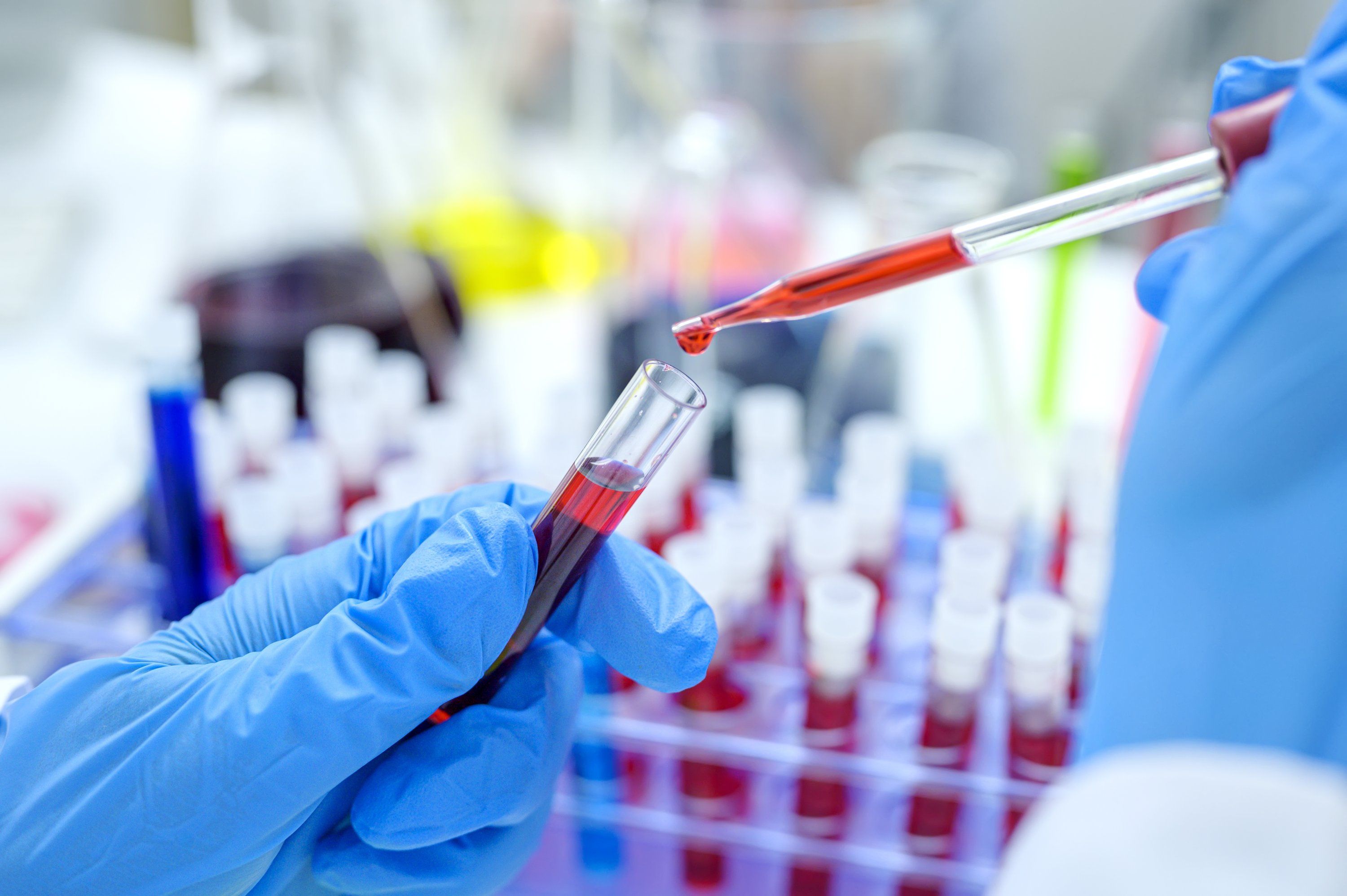 Chances of Getting HIV Complete Guide to Understanding Risk and Prevention